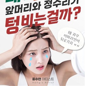 대구 헤어라인교정 1등 전문가 홍수연이 알려주는, 여자도 앞머리와 정수리가 텅 비는 이유!
